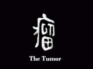 The Tumor